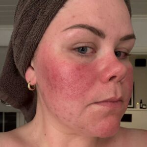 Marthe utbrudd e1764522045350