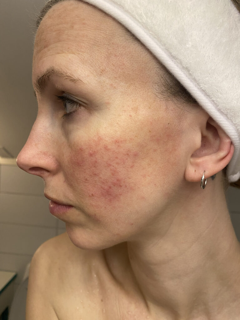 Stine FOR BeeKi kviser IMG 5333