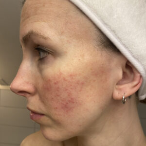 Stine FOR BeeKi kviser IMG 5333 e1764521567331