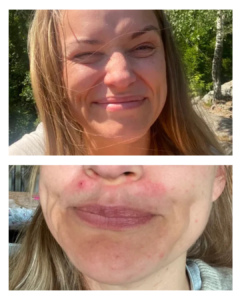 Susanne for etter